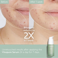 Thumbnail for Caudalie Vinopure Natural Salicylic Acid Pore Minimizing Serum with Niacinamide, Skin Perfecting Serum - 30 mL