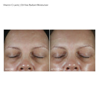 Thumbnail for Dr Dennis Gross VitC+Lactic Oil-Free Radiant Moisturizer, 1.7 fl oz/50ml