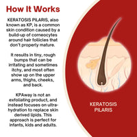 Thumbnail for KPAWAY Moisturizing Keratosis Pilaris Cream for Kids | Gentle Hydration for Dry, Bumpy Skin | Dermatologist-Developed Lotion | Non-Irritating, Acid-Free Formula | 16 oz