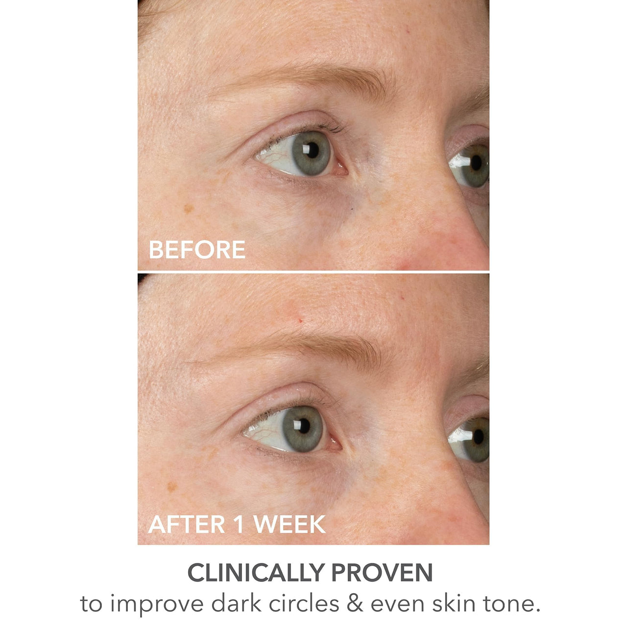 Dr Dennis Gross DermInfusions Lift + Repair Eye Mask | Visibily Lift + Firm, Fills the Appearance of Fine Lines, Deepy Hydrates + Repairs, Visibly Depuffs the Undereye Area | 4 Treatments