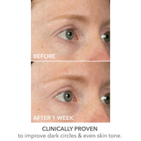 Thumbnail for Dr Dennis Gross DermInfusions Lift + Repair Eye Mask | Visibily Lift + Firm, Fills the Appearance of Fine Lines, Deepy Hydrates + Repairs, Visibly Depuffs the Undereye Area | 4 Treatments