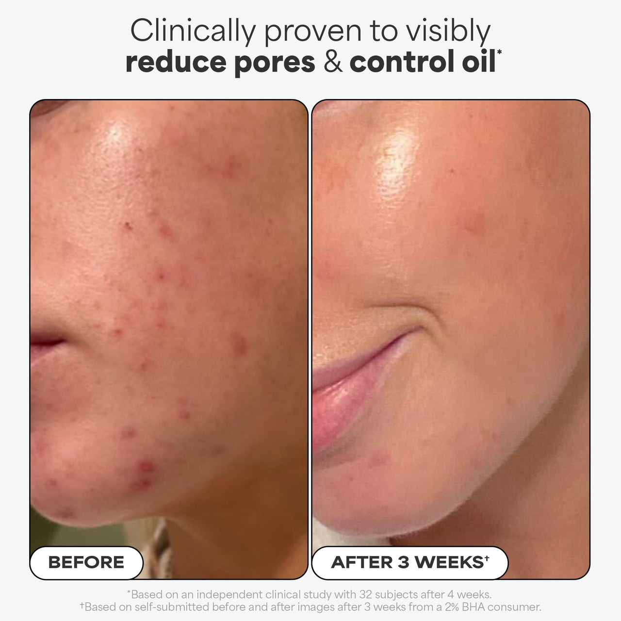 Paula's Choice SKIN PERFECTING 2% BHA Liquid Salicylic Acid Exfoliant-Facial Exfoliant for Enlarged Pores, Wrinkles & Fine Lines, Suitable for Blackhead-Prone Skin, Fragrance-Free