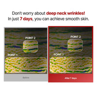 Thumbnail for Wrinkle-fit Neck Mask - Neck Wrinkle Patches, Firming and Tightening Korean Deep Collagen Mask - Hyaluronic Acid NeckTargeted Mesh Sheet Mask for Lifting Sagging Skin - Boosting Elasticity 7EA
