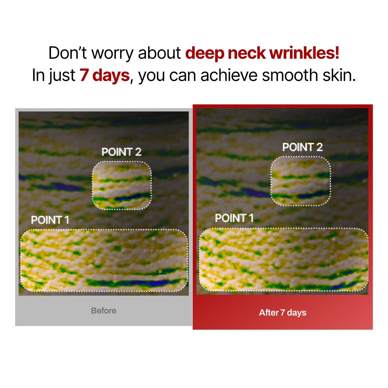 Wrinkle-fit Neck Mask - Neck Wrinkle Patches, Firming and Tightening Korean Deep Collagen Masks - Hyaluronic Acid NeckTargeted Mesh Sheet Mask for Lifting Sagging Skin - Boosting Elasticity 7EA