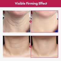 Thumbnail for TOSOWOONG Collagen Necktox Cream with Collagen and Hyaluronic Acid for Neck Firming, Anti-aging, Wrinkles and Tightening, Korean Skin Care, 50ml, 1.69 fl. oz.