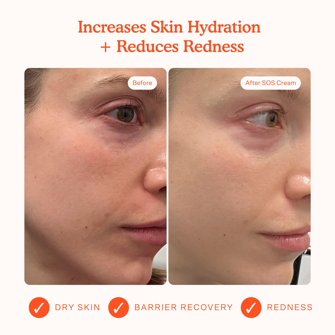 Tower 28 SOS Recovery Face Cream - Hydrating Face Moisturizer with Hyaluronic Acid + Ceramides - Skin Barrier Repair Moisturizer Reduces Redness + Improves Texture - Sensitive Skin Care (1.86 oz)