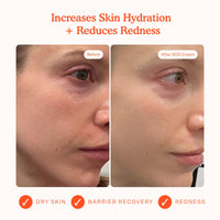 Thumbnail for Tower 28 SOS Recovery Face Cream - Hydrating Face Moisturizer with Hyaluronic Acid + Ceramides - Skin Barrier Repair Moisturizer Reduces Redness + Improves Texture - Sensitive Skin Care (1.86 oz)