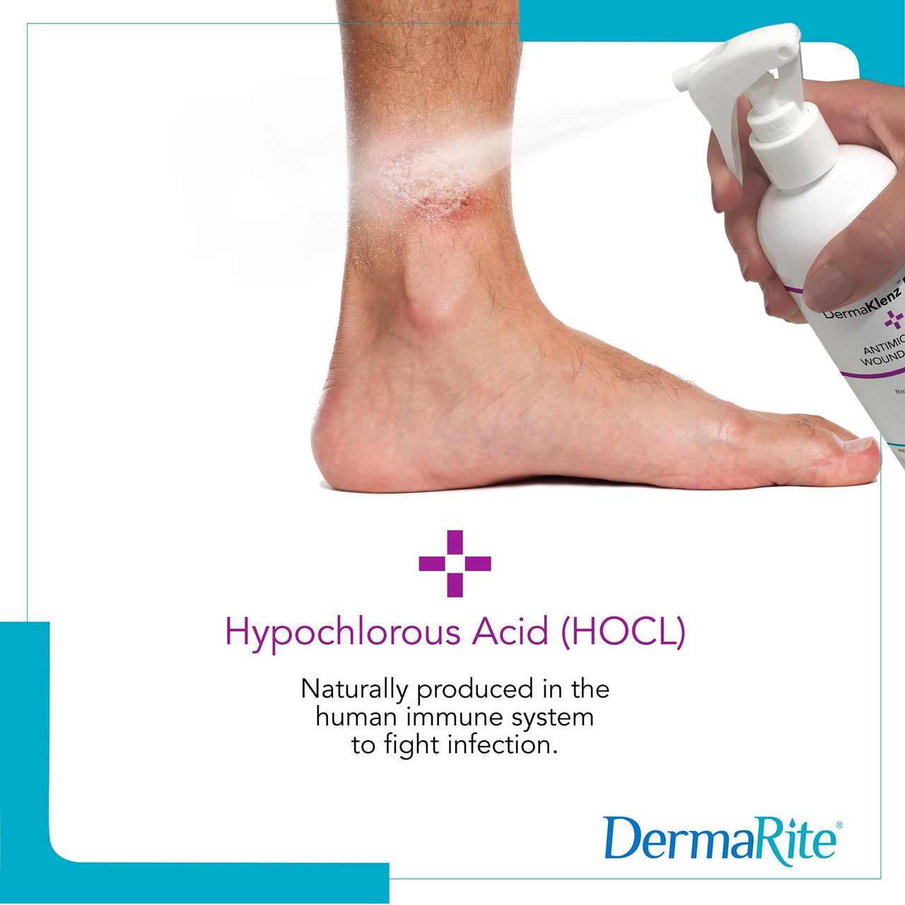 DermaRite's DermaKlenz PLUS Wound Cleanser - Rinse-Free Gentle Cleansing, Helps Clear Wound Debris, Promotes Healing with HOCL - Spray Bottle, 8 oz., 1 Count