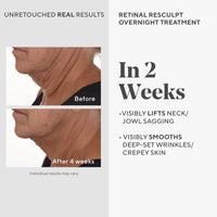 Thumbnail for Murad Retinal ReSculpt Overnight Treatment - Advanced Face and Neck Serum with Encapsulated Retinal, Kangaroo Paw, Olive, & Oat Smooths Deep Wrinkles and Crepey Skin, & Lifts Sagging Skin - 1 Fl Oz