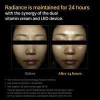 Thumbnail for Vita Real Toning Laser Cream - Face Moisturizer for Hydrating and Glow-enhancing - Face Cream with Vitamin Capsule and Hydration Gel for Uneven Skin Tone - LED Device for Absorption - 1.7 fl. oz