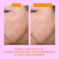 Thumbnail for Drunk Elephant C-Firma Fresh Day Serum - 28 ml/.94 fl oz - 15% Illuminating Vitamin C - Clean Clinical Skincare - Cruelty-Free - Dermatologist-Tested - Free of Essential Oils, Silicones, and Fragrance