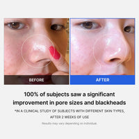 Thumbnail for Medicube Zero Pore Pads 2.0, Dual-Textured Facial Toner Pads for Exfoliation and Pore Care with 4.5% AHA Lactic Acid & 0.45% BHA Salicylic Acid, Ideal for All Skin Types, Korean Skin Care (70 Pads)