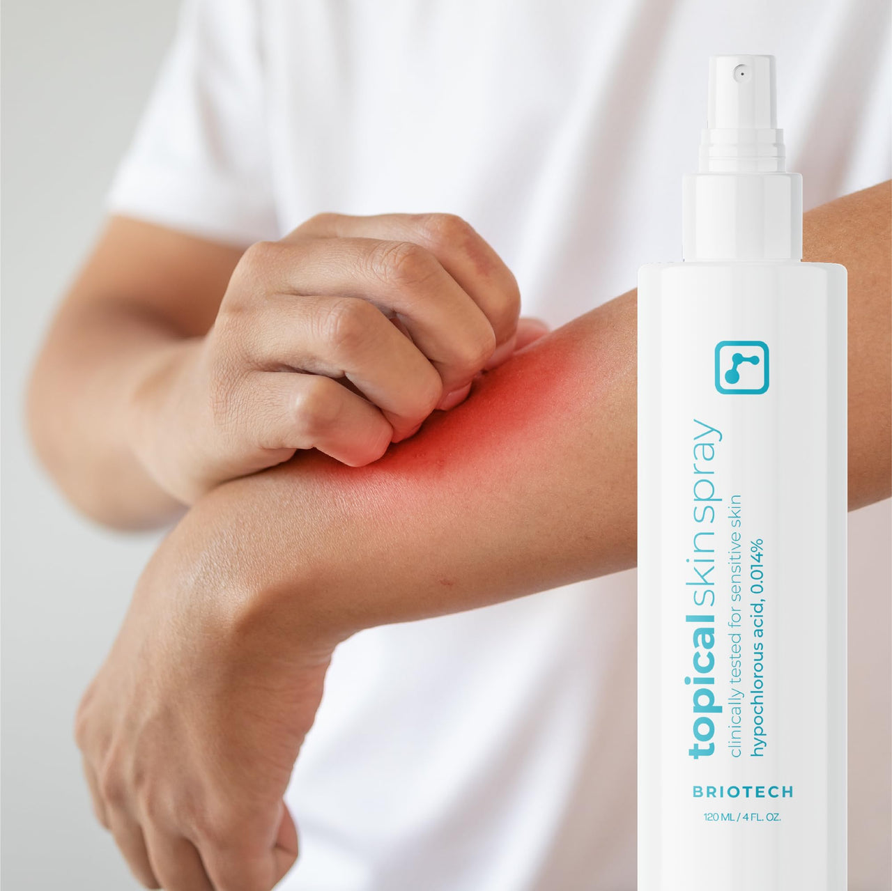 BRIOTECH Topical Skin Spray, Hypochlorous Acid Spray for Body & Face, Eyelid Cleanser, HOCl Facial Mist, Support Against Irritation and Redness, Packaging May Vary, 4oz (1 Pack)