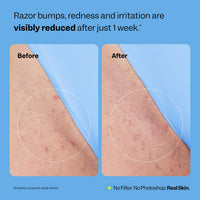 Thumbnail for Peach Slices - Smoothing Solution Ingrown Hair Treatment (1.69 oz) - Smooth, Relieve, Soften Skin - 360 Roller - BHA, AHA, PHA, Niacinamide, Licorice - Vegan & Cruelty Free - Korean Skin Care & Beauty