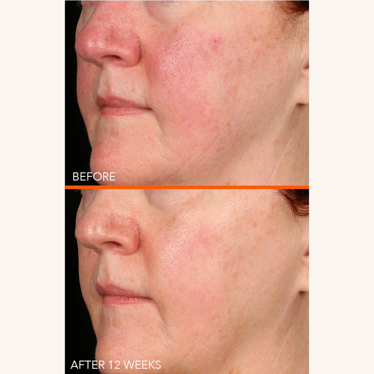 Dr Dennis Gross Vitamin C Lactic 15% Firm & Brighten Serum: Visibly Improve Signs of Aging, 1 oz