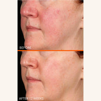 Thumbnail for Dr Dennis Gross Vitamin C Lactic 15% Firm & Brighten Serum: Visibly Improve Signs of Aging, 1 oz