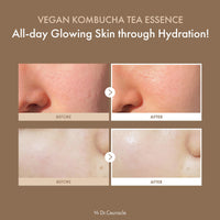Thumbnail for Dr.Ceuracle Vegan Kombucha Tea Essence - Hydrating Milky Toner with Kombucha Tea Extract, Centella Asiatica, Ceramide, Korean Skincare Essence (150 ml / 5.07 fl. oz.)