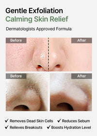 Thumbnail for celimax Ji.Woo.Gae Heartleaf BHA Peeling Pad Double Edition | with Heartleaf Extracts, Exfoliating Toner Pads, Facial Peels, Hydrating, For Troubled Skin & Breakouts, Mother's Day Gift (60pads*2)