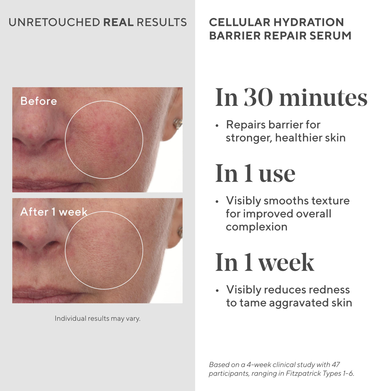 Murad Cellular Hydration Barrier Repair Serum - Hydrating Face Serum Repairs Lipid-Depleted Skin Barrier- Hexapeptide-9, Bilberry, and Hyaluronic Acid Delivers Stronger Healthier Skin - 1 Fl Oz