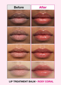 Thumbnail for ISOI Bulgarian Rose Lip Treatment Balm (Rosy Coral) – Hydrating & Tinted Lip Balm for Dry Lips, Korean Skincare (0.18 oz, 5g)