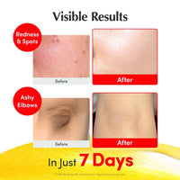 Thumbnail for EQQUALBERRY Vitamin Illuminating Serum | Niacinamide 4% + Brightening Vitamin C Face Serum with Hyaluronic Acid & Vitamin E | Dark Spot, Uneven Tone Care | Korean Skincare, 1.01 fl.oz
