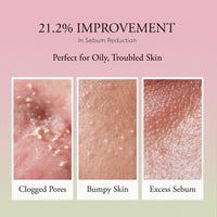 Thumbnail for APRILSKIN Pink Aloe Vita Toner | Calms and Soothes Redness, Smoothens, and Controls Excess Sebum | 80% Pink Aloe Vera Water | Hydrating, Non-Sticky | Clean & Vegan Korean Skin Care (8.45 fl.oz)