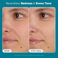 Thumbnail for Paula's Choice Skin Balancing Pore-Reducing Face Toner with Niacinamide, for Oily Skin & Combination, Minimizes Large Pores, Controls Oil & Shine, Hydrates & Replenishes, Fragrance-Free, 6.4oz