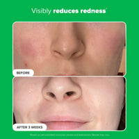 Thumbnail for Paula's Choice BOOST 10% Azelaic Acid Booster Cream Gel, Licorice Extract & Salicylic Acid, Oil-Free Skin Brightening Serum, 1 Ounce