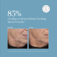 Thumbnail for Naturium Retinol Complex Serum, Encapsulated Retinols & Bakuchiol, Refining & Smoothing Facial Serum, 1 oz