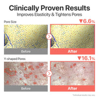 Thumbnail for numbuzin No.3 Super Glowing Essence Toner, Fermented Toner for Skin Glow & Texture, Bifida, Niacinamide, Hydrating, Radiance-Boosting Essence, Zero Pore Care, 6.76 fl oz (200ml)