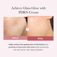 Thumbnail for medicube Salmon DNA PDRN Pink Hyaluronic Moisturizing Cream | Blemish Relief & Hydrating Care | Restores Skin Elasticity & Glow | Korean Skincare, Even Skin Tone & Pore Care | 50ml / 1.69 fl.oz.