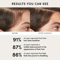 Thumbnail for OUAI Scalp Serum - Balancing Hair Serum with Red Clover Extract, Siberian Ginseng and Peptides for Thicker and Fuller-Looking Hair - Paraben, Phthalate and Sulfate Free Scalp Care (2 Fl Oz)