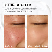 Thumbnail for NEAF NEAF Soothing Calm Toner Pad, Daily Gentle Exfoliating & Hydrating Facial Pads for Intense Soothing Care, Heartleaf Extract and CICA for Sensitive Skin Safe, Korean Skincare (60 Pads)