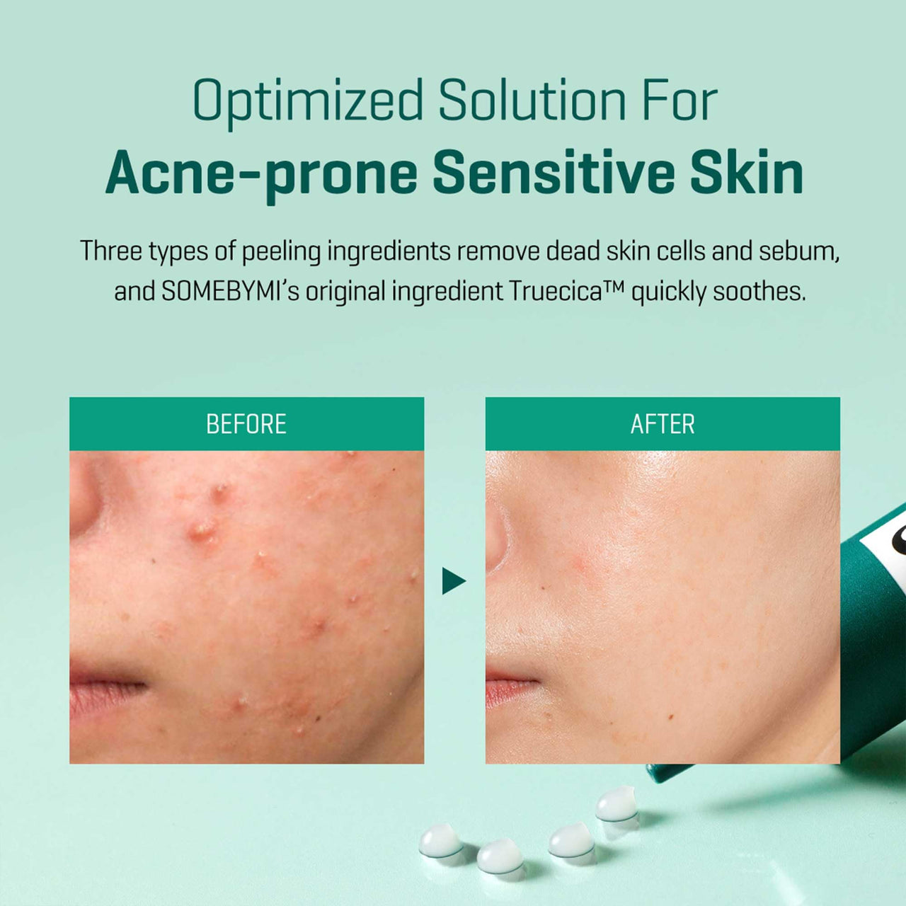 SOME BY MI AHA BHA PHA 14 Days Super Miracle Spot All Kill Cream - 1.01oz, 30ml - Hyaluronic Acid and Centella Face Moisturizer for Troubled Skin Care - Hydrating & Soothing Fomula - Korean Skin Care