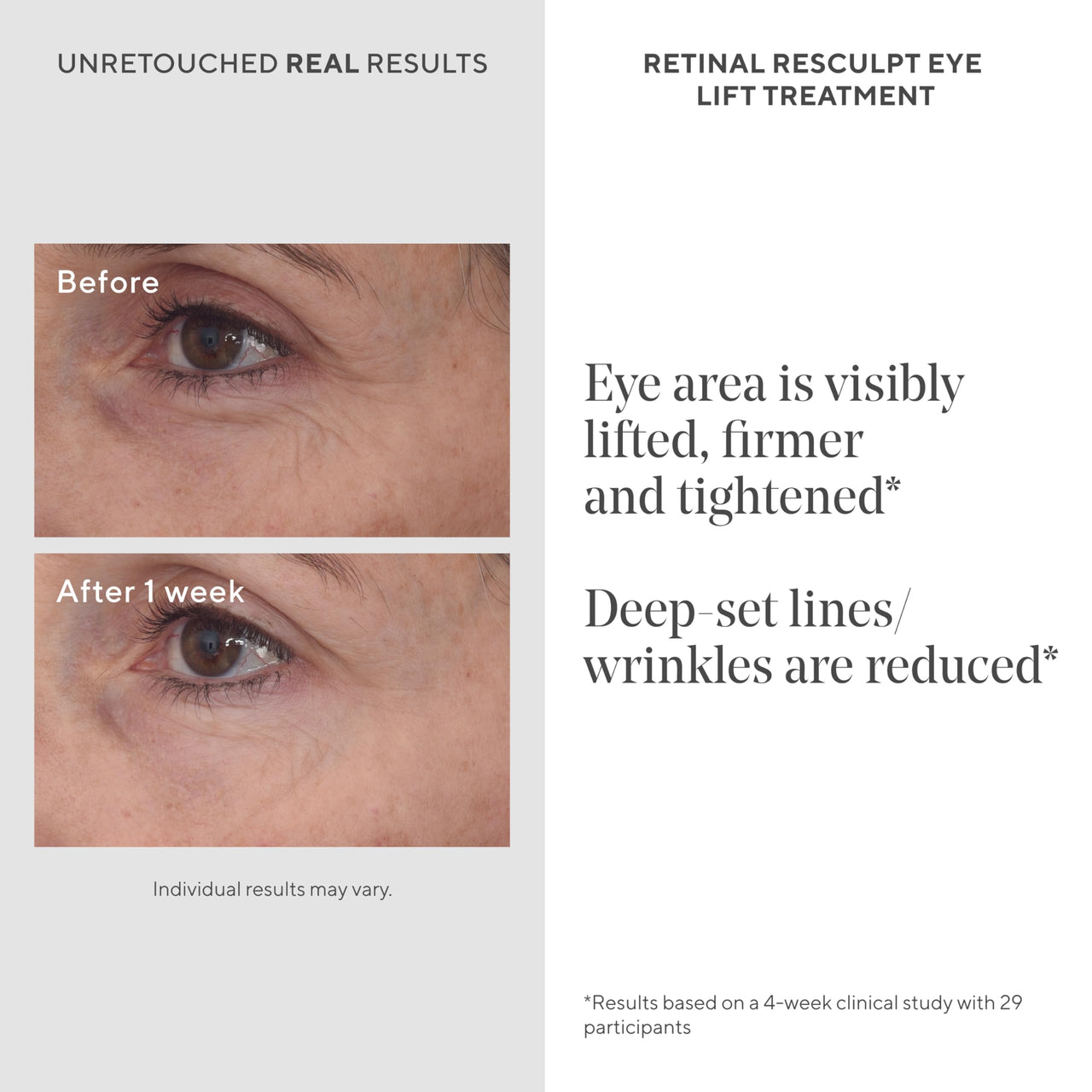 Murad Retinal ReSculpt Eye Lift Treatment - Age-Defying Eye Cream with Encapsulated Retinal, Gentian Root, & Oat-Firming Film for Youthful Eyes - Tightens Droopy Lids & Under-Eye Bags - 0.5 Fl Oz