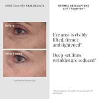 Thumbnail for Murad Retinal ReSculpt Eye Lift Treatment - Age-Defying Eye Cream with Encapsulated Retinal, Gentian Root, & Oat-Firming Film for Youthful Eyes - Tightens Droopy Lids & Under-Eye Bags - 0.5 Fl Oz