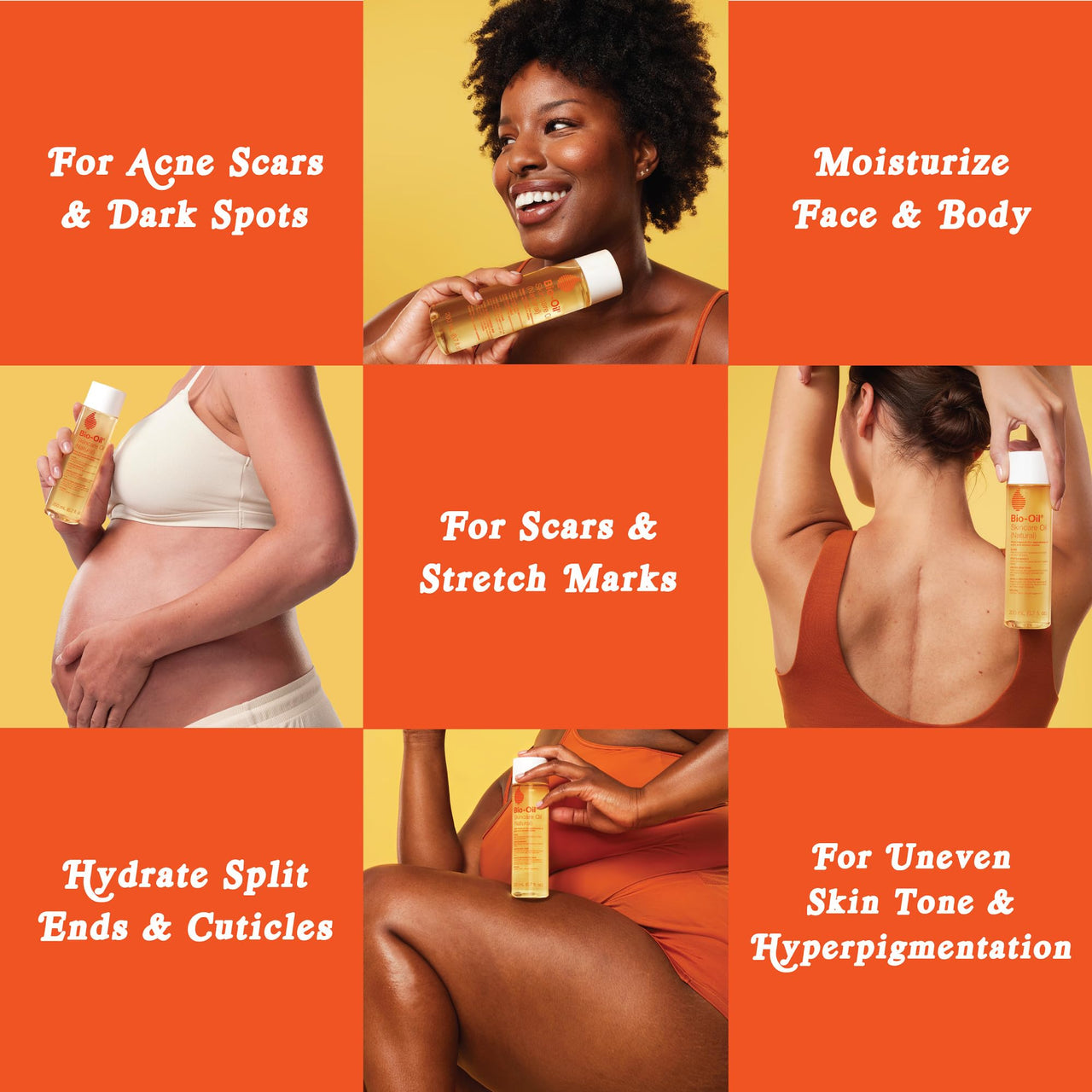 Bio-Oil Natural Skincare Oil Serum, Face and Body Moisturizer with Chamomile, Rosehip, and Lavender Oil, for Scars, Stretch Marks, Sensitive Skin, All Skin Types, 0.85 Oz, Pack of 3