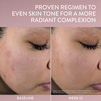 Thumbnail for Cetaphil Healthy Radiance Brightness Refresh Face Toner, 150ml, for Hyperpigmentation, with Niacinamide
