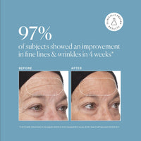 Thumbnail for Naturium Retinol Complex Serum, Encapsulated Retinols & Bakuchiol, Refining & Smoothing Facial Serum, 1 oz