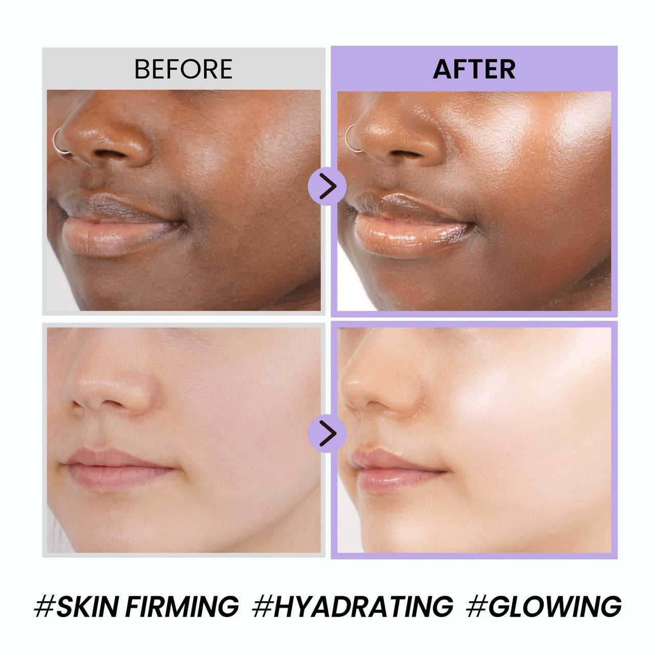 coxir BLACK SNAIL COLLAGEN CREAM l Snail Mucin, Collagen, Black Rice, Peptide l Moisturizing, Firming, Skin Barrier l Korean Skin Care, Moisturizer [50ml/1.69 fl.oz]