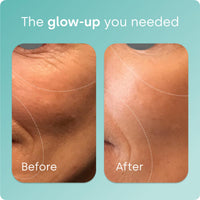 Thumbnail for Biosil Collagen Booster Supplement - 30 Original Capsules - Patented ch-OSA Activator for Skin, Hair, Nails & Joints - Supports Natural Production - 15-Day Supply