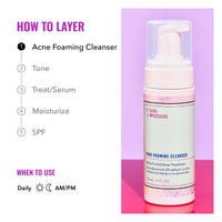 Thumbnail for Good Molecules Acne Foaming Cleanser - 2% Salicylic Acid Foam Cleanser - Gentle Acne Face Wash with Alcohol Free Witch Hazel and Aloe - Skin Care for Face