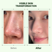 Thumbnail for Orien Mugwort Zero Film Cleansing Oil 6.76 fl.oz. 200ml ㅣDaily Makeup Blackhead Removal No pore clogging Korean skincare double cleansing