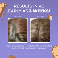 Thumbnail for MaryRuth Organics Women's Hair Growth MAX Liposomal | with Lustriva® + Biotin 10000mcg + Pumpkin Seed Oil | Thicker Hair | Hair Care | Wrinkles, Fine Lines, Skin Care | Ages 18+ | 15.22 Fl Oz