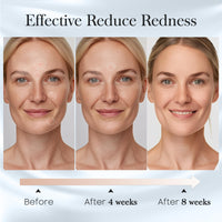 Thumbnail for Fygrip 100 Count (2 Box) XL Disposable Face Towels 10” x 12”, 100% Viscose Fibre, Soft & Skin Friendly Face Towelettes Disposable, Facial Tissue Wipes for Women Cleansing