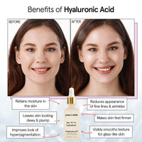 Thumbnail for grace & stella Award Winning Hyaluronic Acid Serum (10ml/0.34 fl oz) Hyaluronic Acid Serum for Face - Acido Hialuronico Face Serums for Women - Hydrating, Remove Fine Lines, Wrinkles - Anti Aging