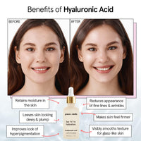 Thumbnail for grace & stella Award Winning Hyaluronic Acid Serum (10ml/0.34 fl oz) Hyaluronic Acid Serum for Face - Acido Hialuronico Face Serums for Women - Hydrating, Remove Fine Lines, Wrinkles - Anti Aging