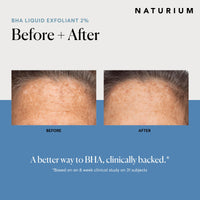 Thumbnail for Naturium BHA Liquid Exfoliant 2%, Leave-on Face & Skin Care Exfoliating Pore Treatment, with Salicylic Acid & Bioactive Fruit Acids, Packaging May Vary, 4 oz