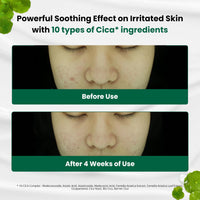 Thumbnail for Dr.G Red Blemish Clear Soothing Korean Moisturizer Face Cream, 70ml - Cica Cream, Korean Skin Care Moisturizer, Korean Face Moisturizer, Facial Moisturizer, Korean Skincare, K Beauty Skincare Coreano