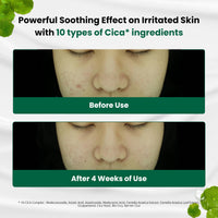 Thumbnail for Dr.G Red Blemish Clear Soothing Korean Moisturizer Face Cream, 70ml - Cica Cream, Korean Skin Care Moisturizer, Korean Face Moisturizer, Facial Moisturizer, Korean Skincare, K Beauty Skincare Coreano